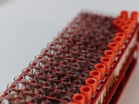 Laboratory test tubes standing in a rack