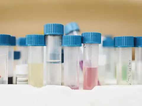 Laboratory test tubes with blue caps in a row
