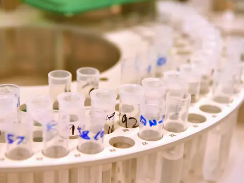Labeled water sample cups in the tray of a laboratory analyzer