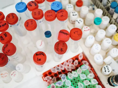 Laboratory sample tubes and bottles with colored caps seen from above